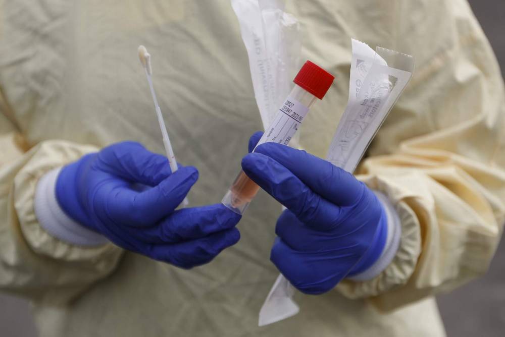 US slashes testing rules to speedup coronavirus screening - clickorlando.com - Usa - area District Of Columbia - Washington, area District Of Columbia