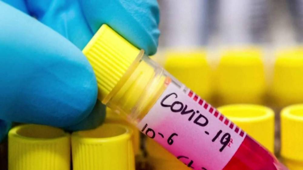Sunshine State - Florida coronavirus death toll rises to 8, latest numbers show - clickorlando.com - state Florida - county Clay
