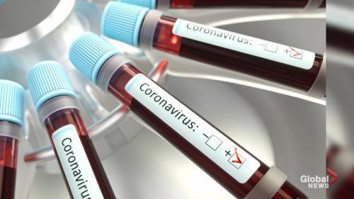 Coronavirus outbreak: FDA approves new COVID-19 test kit - globalnews.ca - Usa