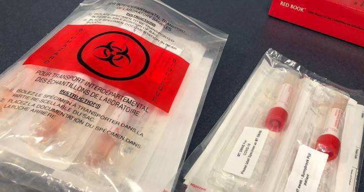 Coronavirus: St. Joe’s hospital in Hamilton implements no-visitor policy during COVID-19 pandemic - globalnews.ca - county Hamilton - county St. Joseph