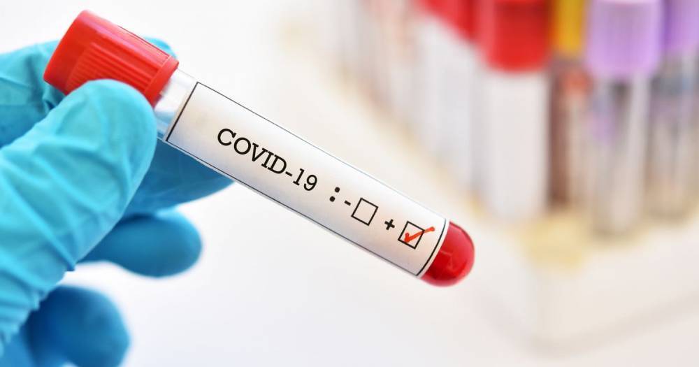Coronavirus test that can diagnose disease in 45 minutes is approved for use - mirror.co.uk - Usa - state California