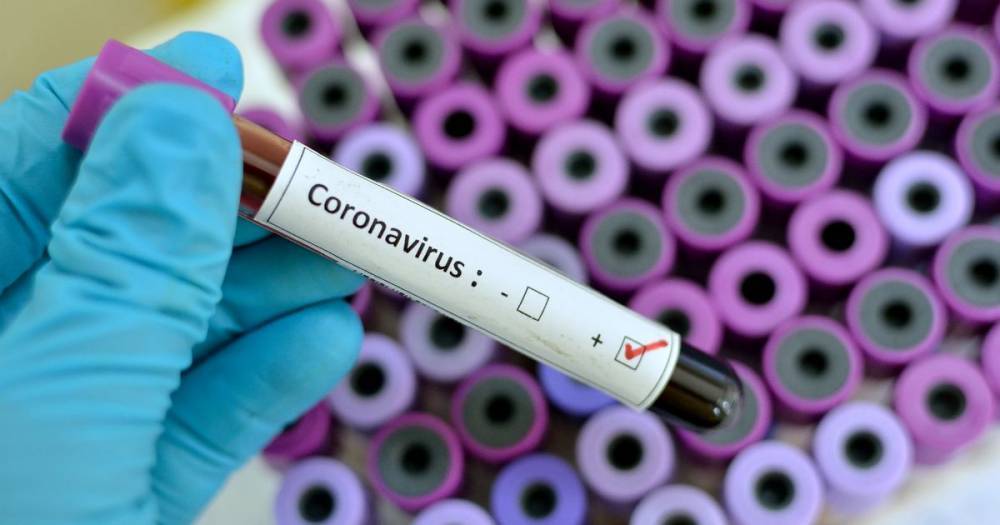 Coronavirus: 'Disappointing' study suggests HIV treatments aren't effective against bug - mirror.co.uk - city Wuhan - Britain