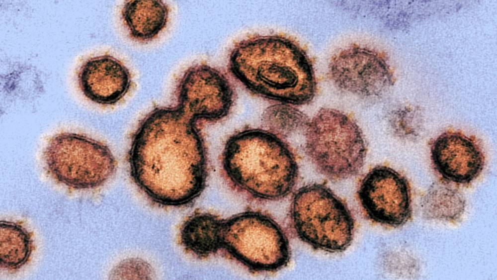 WHO launches global megatrial of the four most promising coronavirus treatments - sciencemag.org - Usa