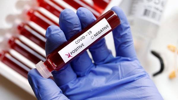 Coronavirus: Medical research body ICMR floats tender to buy 1 million test kits - livemint.com - city New Delhi - India - city Mumbai - city Chennai - city Delhi - city Hyderabad