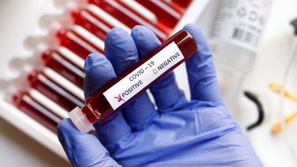 Anthony Fauci - Coronavirus could become seasonal: Top US scientist - livemint.com - Usa