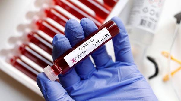 Bosch's latest coronavirus test shortens wait to 2.5 hours from 2 days - livemint.com - Germany - Ireland