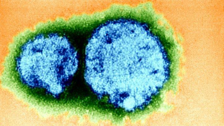 Hantavirus kills man in coronavirus-hit China, 32 others tested, report says - fox29.com - China