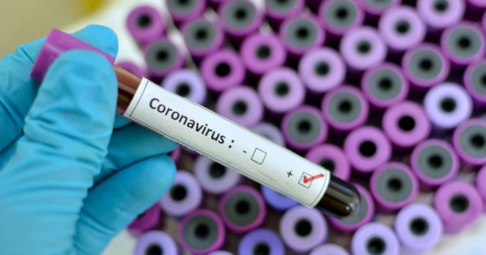 UK coronavirus death toll jumps to 578 as pandemic claims a further 115 victims - dailyrecord.co.uk - Britain - Scotland