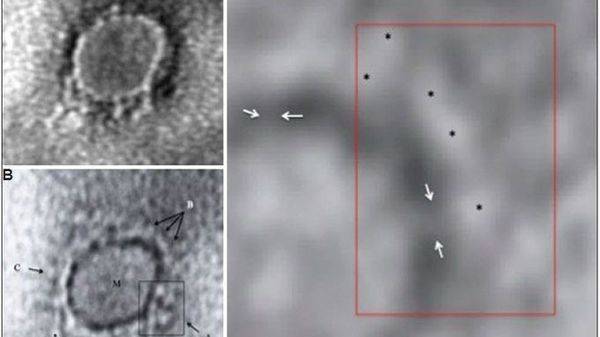 Indian scientists reveal first microscopic image of novel coronavirus - livemint.com - city New Delhi - India