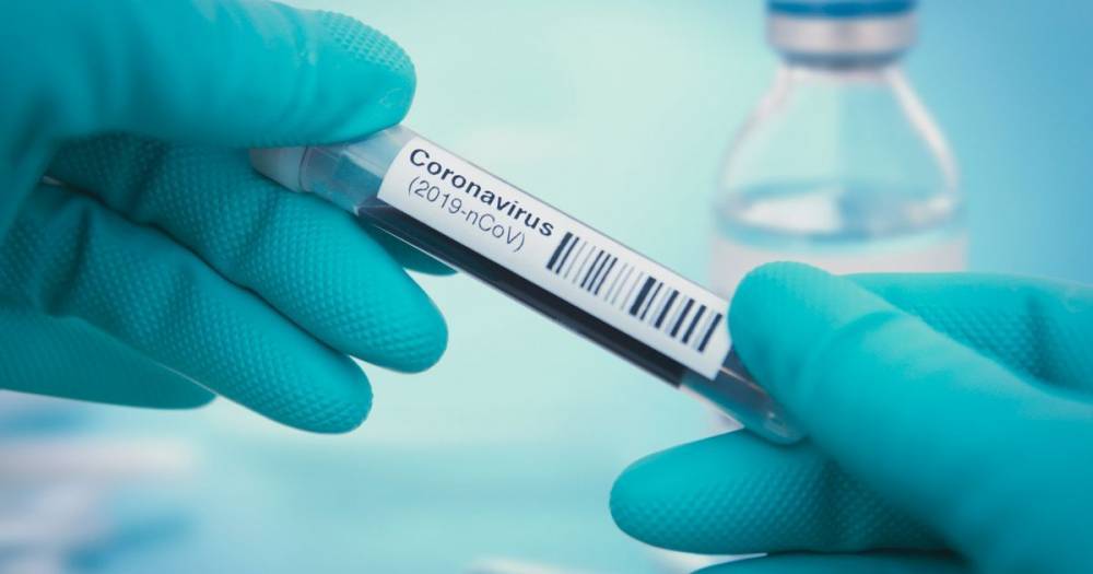 Coronavirus: NHS symptoms list is 'too short and misses mild signs' experts warn - mirror.co.uk - Britain - France
