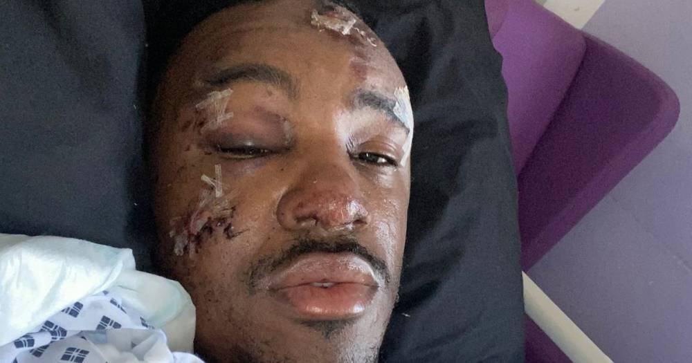 Bugzy Malone - Aaron Davies - Rapper Bugzy Malone shares grim pictures of his injuries from hospital after horror crash - mirror.co.uk - city Manchester