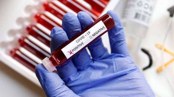 Coronavirus: Human testing for Johnson & Johnson COVID-19 vaccine by Sept - livemint.com - Usa