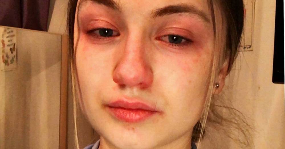 Tearful nurse, 19, says she 'sees pain' of coronavirus patients as she treats them - mirror.co.uk