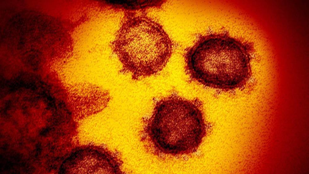 Sunshine Florida - Another jump: Number of coronavirus cases in Florida swells to 6,338 - clickorlando.com - state Florida