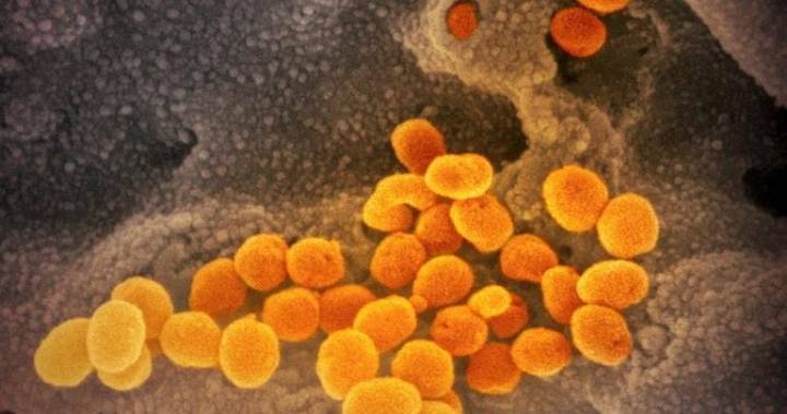 1st coronavirus-related death reported in Waterloo Region - globalnews.ca - city Waterloo - parish St. Mary