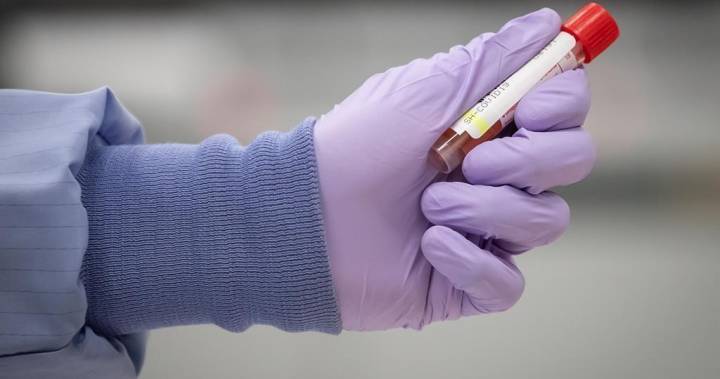 Coronavirus: Ontario researchers race toward treatment, vaccine for COVID-19 - globalnews.ca
