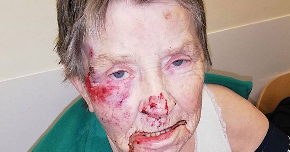 Vulnerable gran found bleeding face-down in road at 2am was 'failed' by carers - dailystar.co.uk