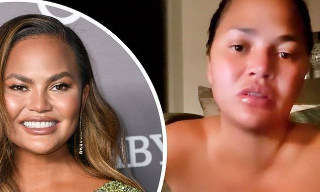 Chrissy Teigen - Chrissy Teigen is makeup-free as she admits anxiety over COVID-19 gives her insomnia - dailymail.co.uk