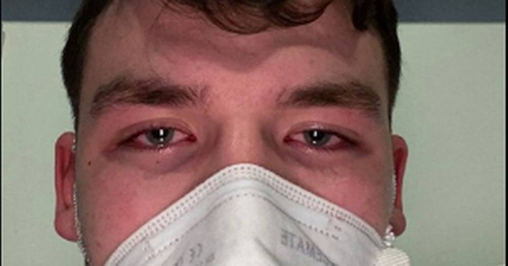 Boy, 17, 'thought he'd die' of coronavirus after 'terrifying' hospital experience - dailystar.co.uk - Ireland - city Dublin, Ireland