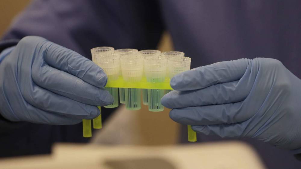 DIY at-home coronavirus saliva testing kits released to help alleviate hospital, testing site strain - clickorlando.com