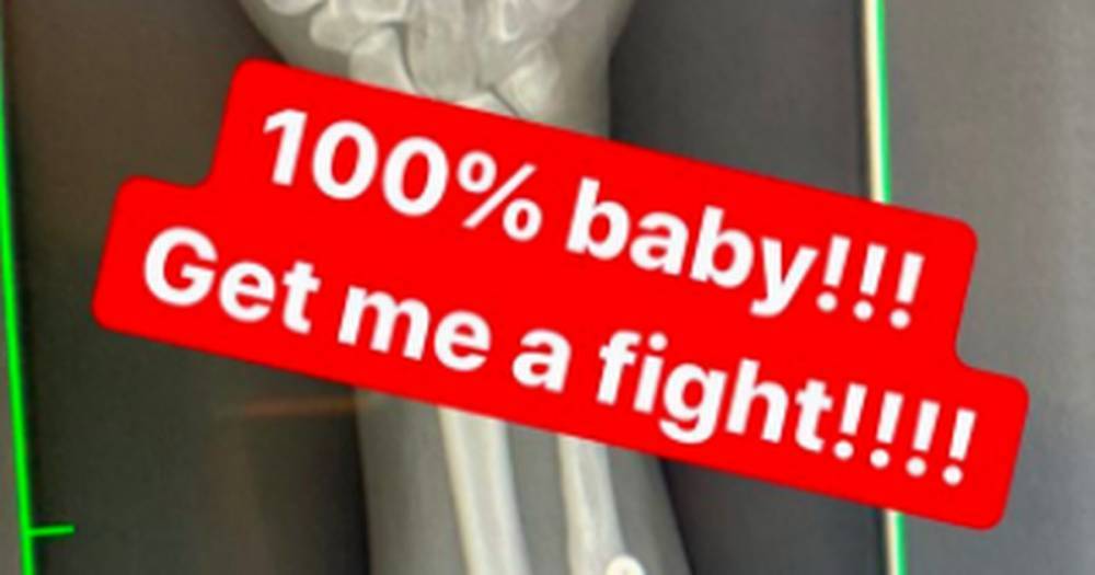 Amanda Ribas - Paige VanZant shows x-ray of healed broken arm as UFC beauty demands return fight - dailystar.co.uk