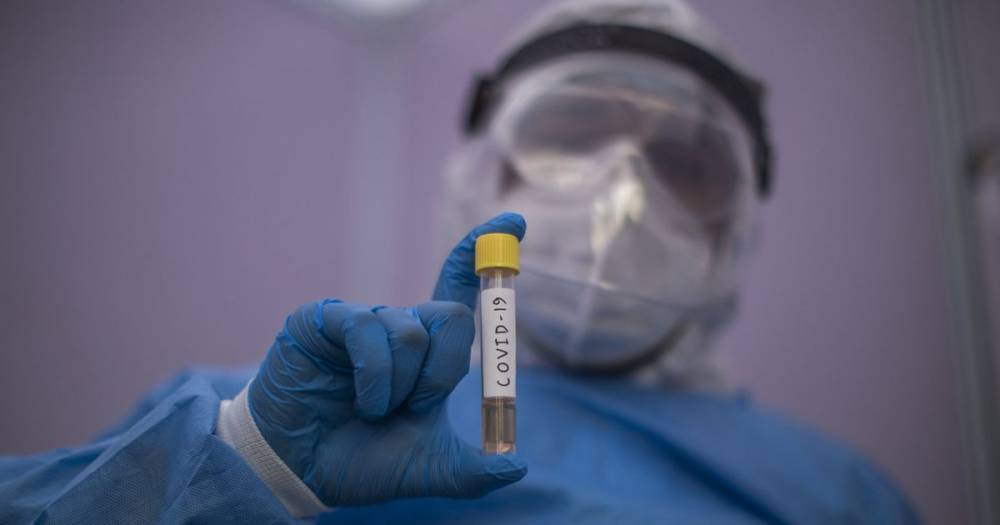 UK coronavirus death toll rises by 596 in 24 hours - manchestereveningnews.co.uk - Britain - Scotland