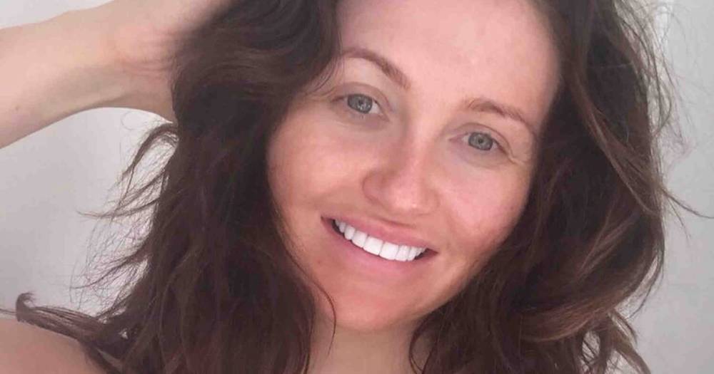Charlotte Dawson laid bare in makeup-free selfie as she talks filler 'obsession' - dailystar.co.uk - Charlotte, county Dawson - city Charlotte, county Dawson - county Dawson