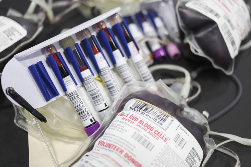 US eases blood donation limits for gay men due to shortage - clickorlando.com - Usa - Washington - county Cross - city Adams, county Jerome - county Jerome