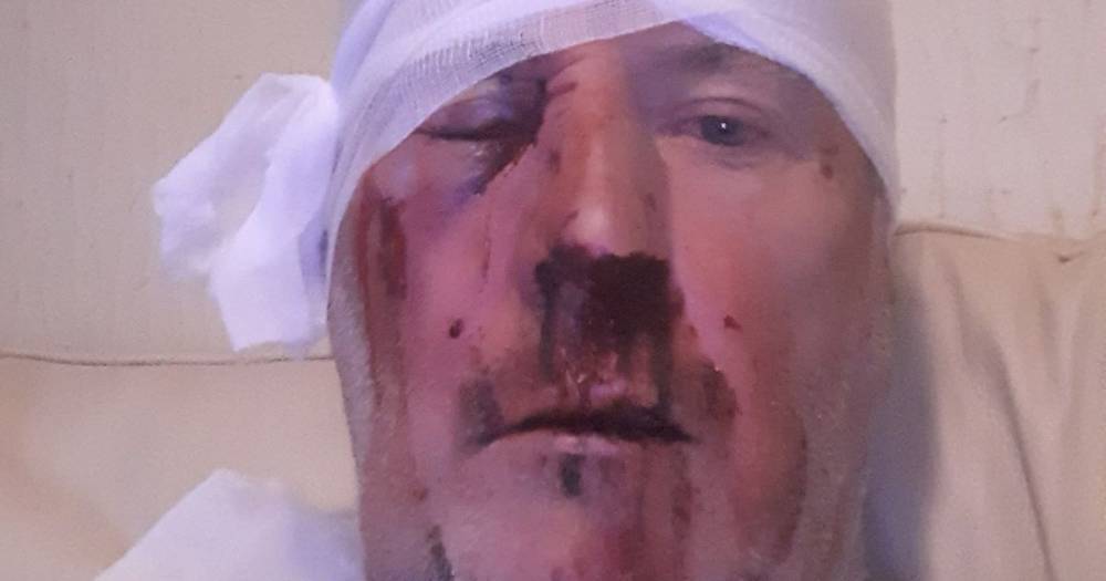 Scots bin lorry driver stabbed in head and battered to pulp after tackling yobs throwing buckets in old lady's garden - dailyrecord.co.uk - Scotland