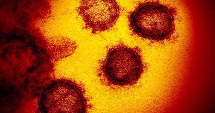Coronavirus: U.S. approves 1st at-home test for health-care workers, first responders - globalnews.ca - Washington