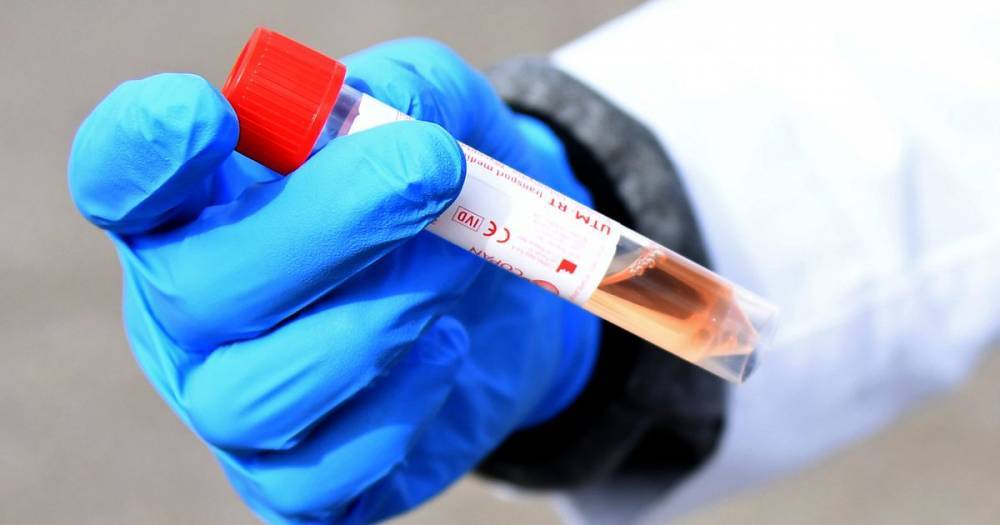 UK coronavirus death toll rises by 763 in 24 hours - manchestereveningnews.co.uk - Britain