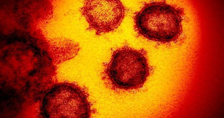 Coronavirus: 3 deaths, 2 new cases reported at London-Middlesex seniors’ facilities: MLHU - globalnews.ca - city London - county Middlesex