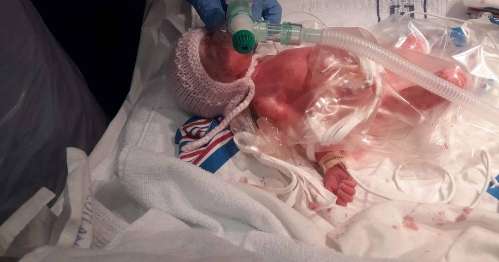Mum of Scots tot born weighing less than 3lbs urges people to 'stay at home' - dailyrecord.co.uk - Germany - Britain - Scotland - Georgia