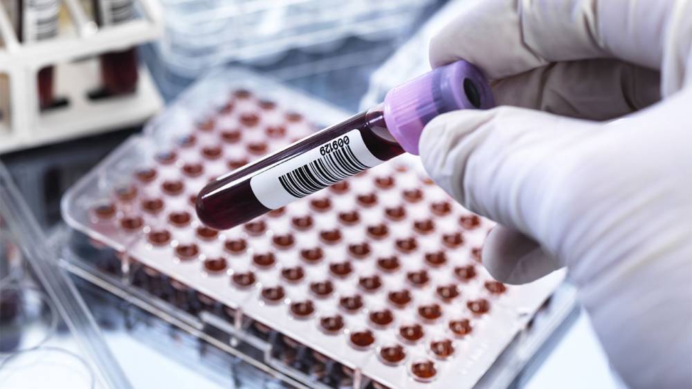 Blood tests spot cancers before symptoms appear, but also produce false positives - sciencemag.org