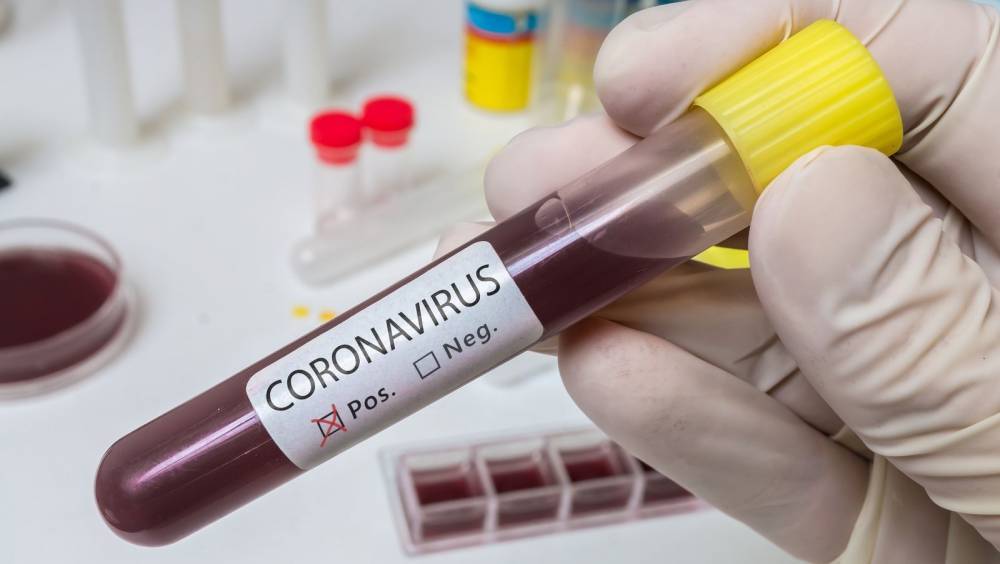 Anthony Fauci - Gilead Sciences - US says Remdesivir shows 'clear-cut' effect in treating coronavirus - rte.ie - Usa