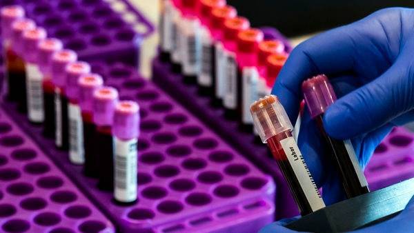 ICMR recommends antibody test for speedy detection of coronavirus cases - livemint.com - city New Delhi - India