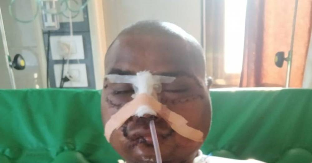 Farmer's face ripped off by plough after falling off tractor - dailystar.co.uk - India - city Pune