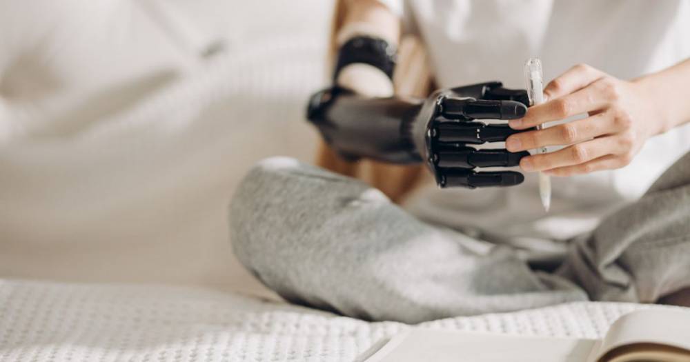 Bionic arm users can control with their thoughts may be 'available in two years' - dailystar.co.uk - Eu - Sweden