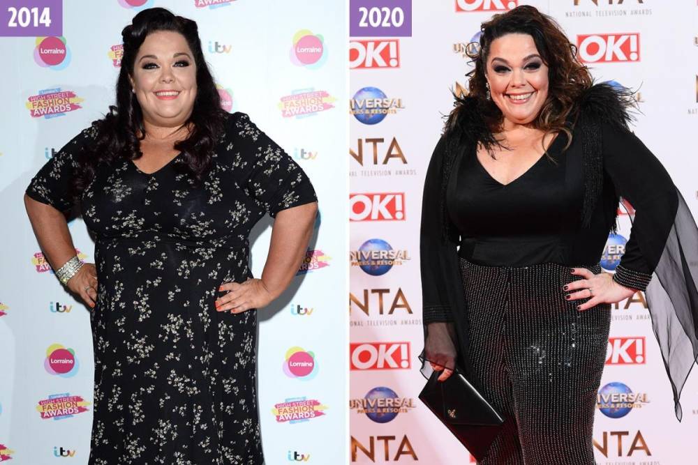Lisa Riley - Emmerdale’s Lisa Riley reveals she had one and a half stone of excess skin sliced off as part of her weight loss journey - thesun.co.uk