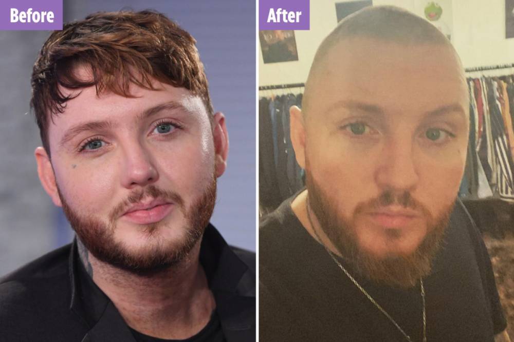 James Arthur - James Arthur accidentally shaves his head and decides to donate £5k to NHS - thesun.co.uk
