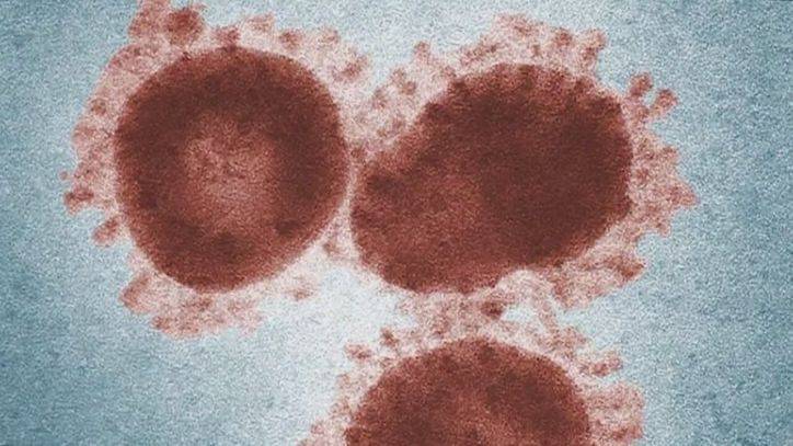 Half of people with coronavirus have no symptoms, data shows - fox29.com - Italy - Iceland
