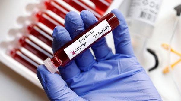 Coronavirus: Drugs, antibody tests will make all the difference - livemint.com - Britain