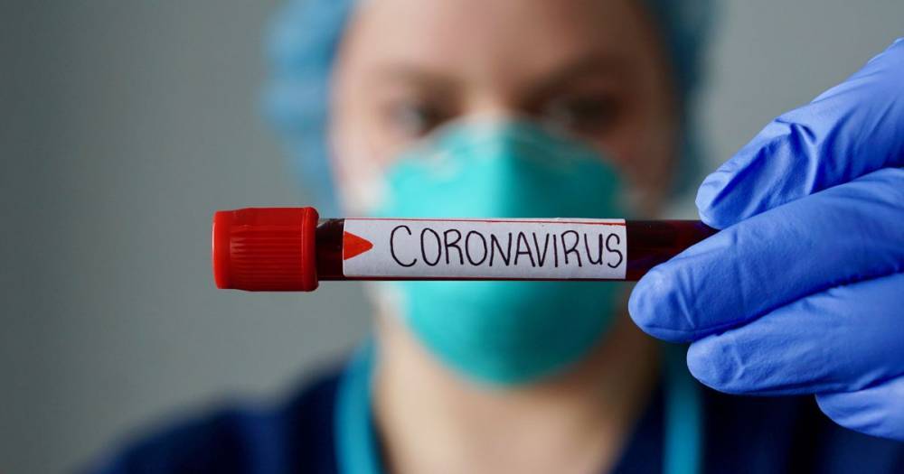UK records biggest increase in coronavirus deaths with more than 850 in one day - manchestereveningnews.co.uk - Britain - city London - county Midland