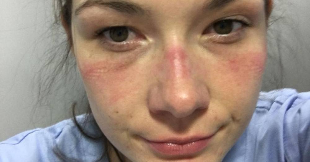 NHS hero says fighting coronavirus feel like she's been punched in the face - mirror.co.uk
