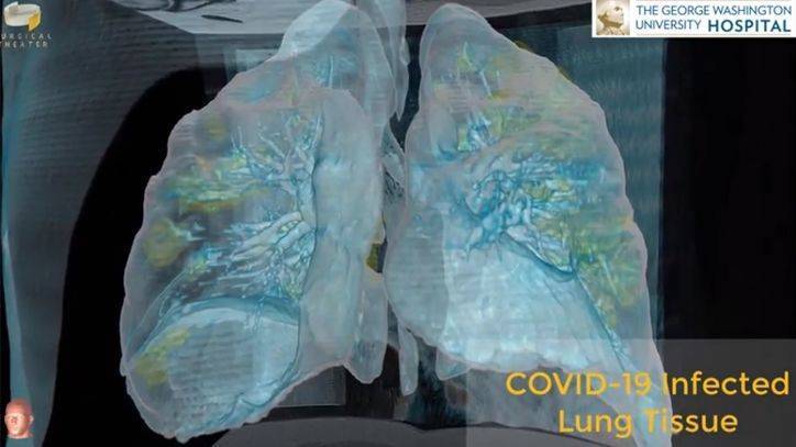 Keith Mortman - ‘It is affecting every age group’: 3D video shows extensive damage to lungs caused by COVID-19 - fox29.com - Los Angeles - Washington, county George - county George