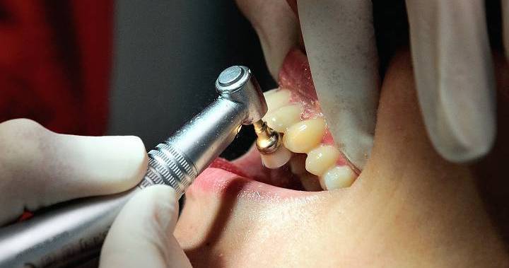 Reports of Alberta dentists performing non-emergency services ‘alarming’: registrar - globalnews.ca