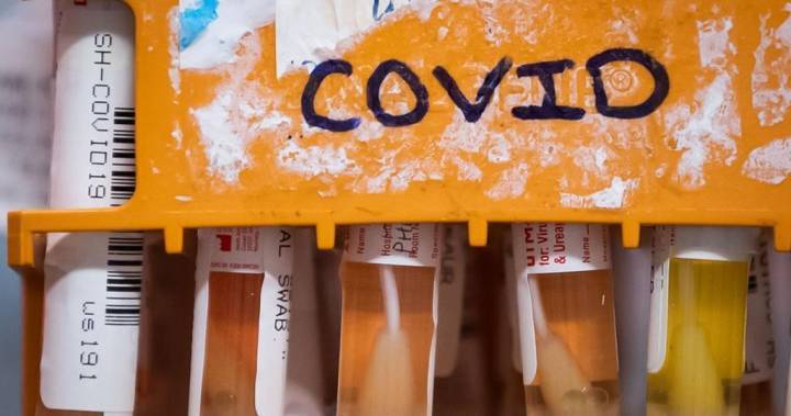 Coronavirus: Simcoe Muskoka health unit confirms 7 new cases, local total now 115 - globalnews.ca