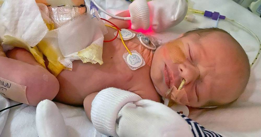 Miracle baby survives after mum told to abort him at 14 weeks as intestines grew on outside - dailystar.co.uk