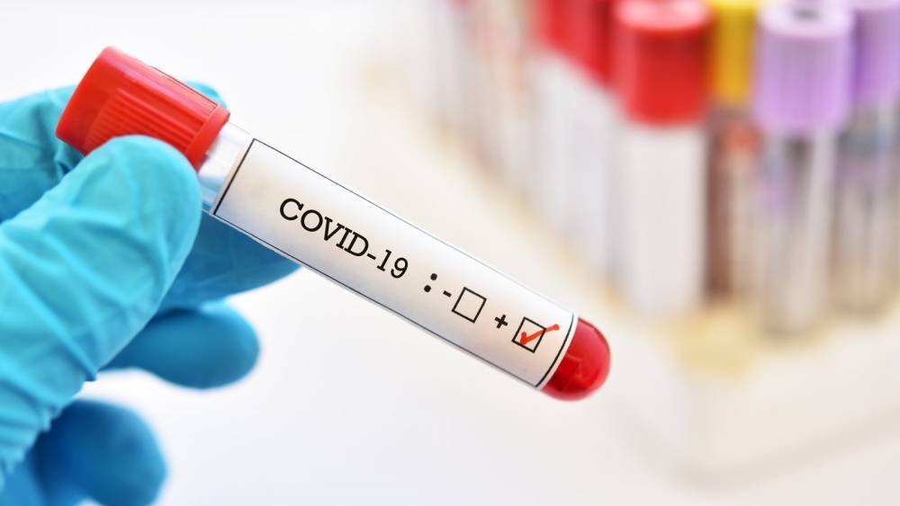 34 more people diagnosed with Covid-19 have died, 221 additional cases - rte.ie - Ireland - city Dublin