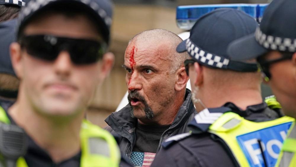 10 held, policeman injured, at anti-lockdown protest in Melbourne - rte.ie - Australia - city Melbourne, Australia